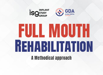 Full mouth Rehabilitation